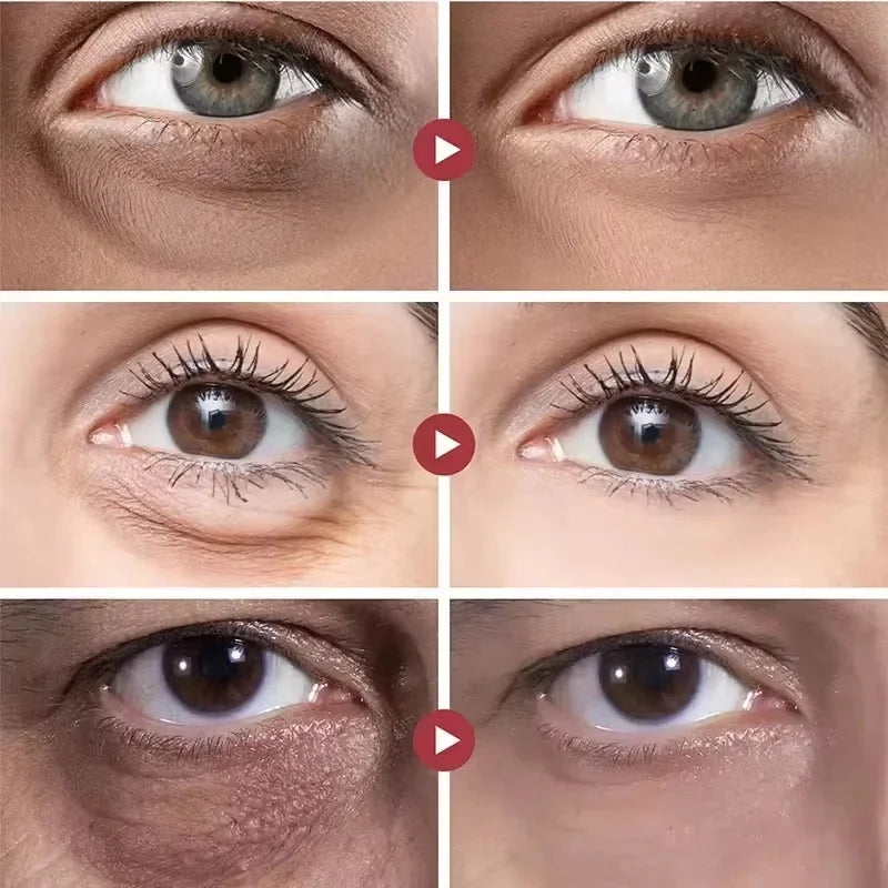 Instant Eye Bag Removal Cream Collagen Anti-Wrinkle Fade Fine Lines Firming Skin Anti Dark Circle Puffiness Brighten Eye Care